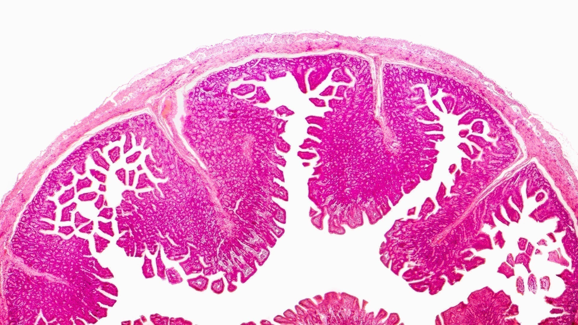 ¿Que es la Microbiota?